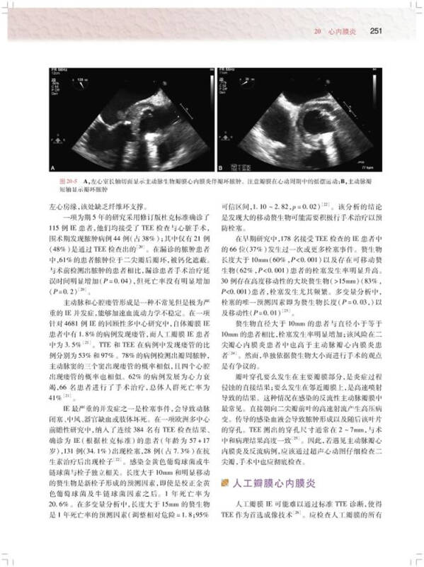 围术期经食管超声心动图学(翻译版)