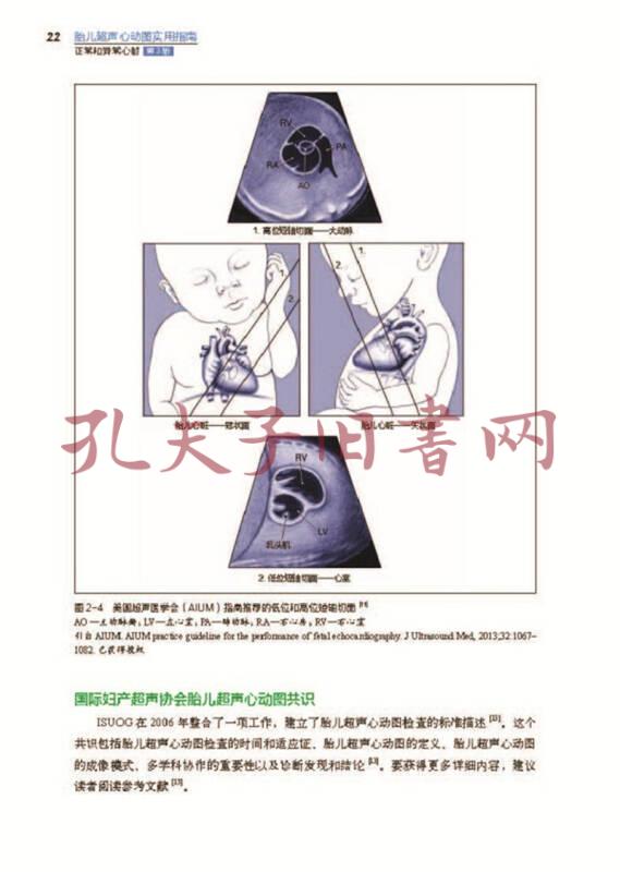 胎儿超声心动图实用指南:正常和异常心脏(第3版)