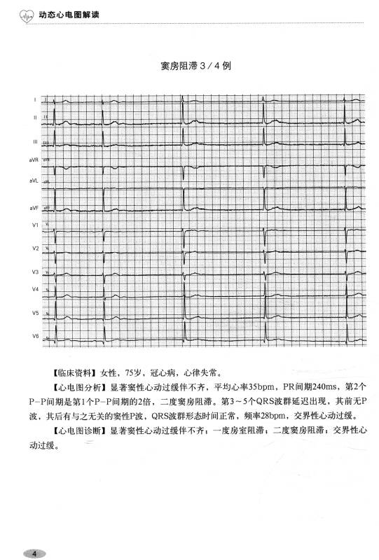 心电图临床应用参考书:动态心电图解读