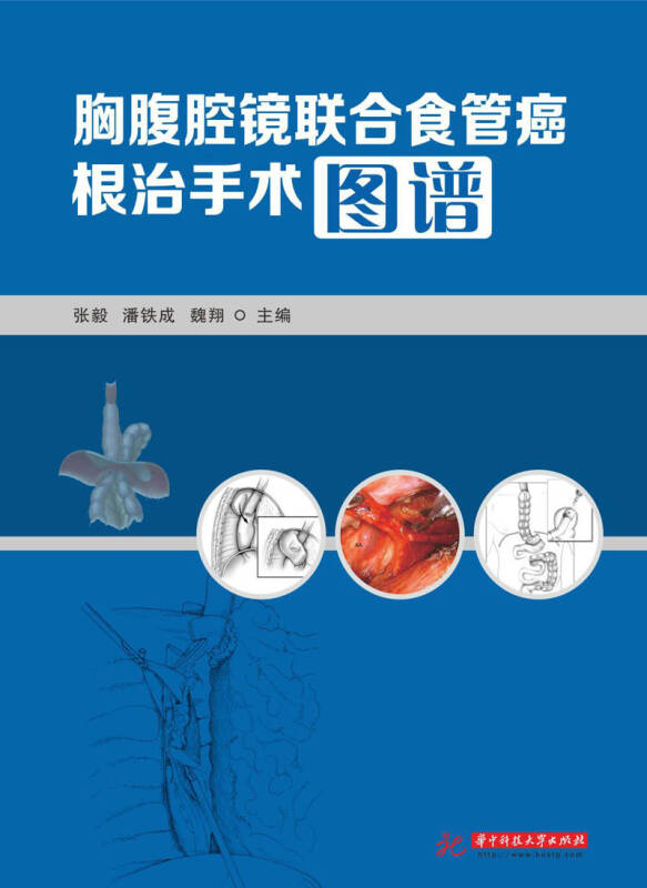 胸腹腔镜联合食管癌根治手术图谱