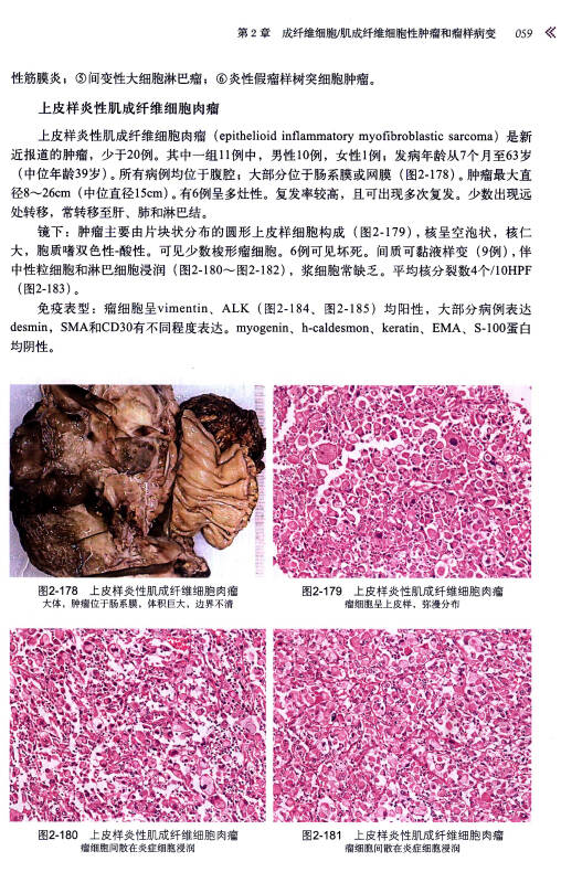 软组织肿瘤病理学诊断图谱