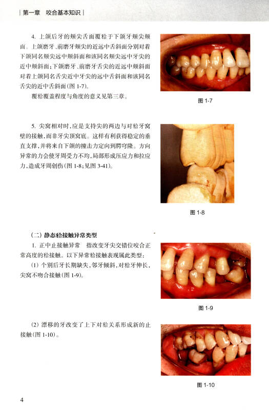 口腔住院医师专科技术图解丛书:咬合检查与咬合调整病例图解