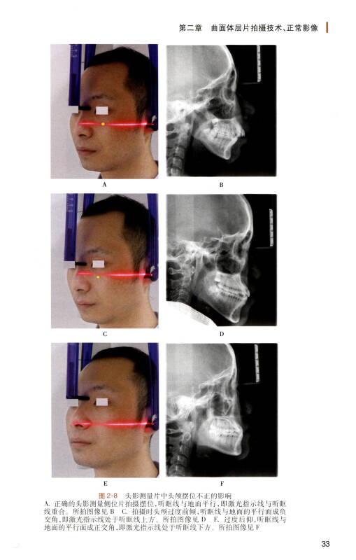 数字化口腔颌面x线设备临床应用图解/数字化口腔临床技术图解丛书