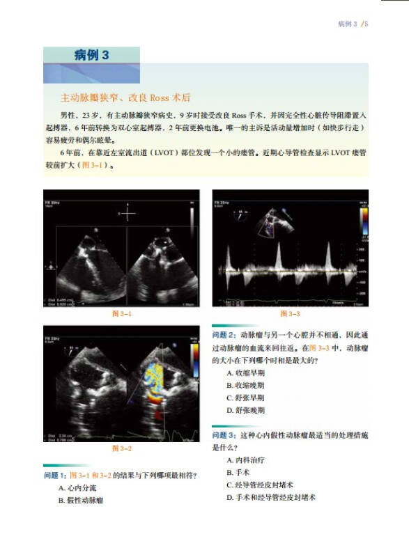 超声心动图典型病例荟萃
