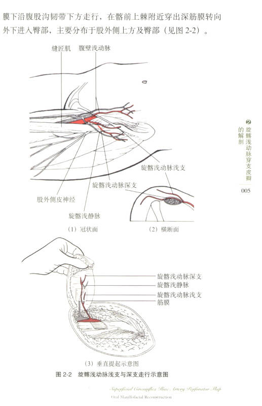 旋髂浅动脉穿支皮瓣:口腔颌面部应用