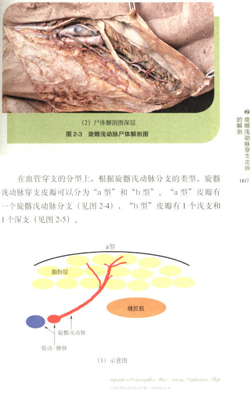 旋髂浅动脉穿支皮瓣:口腔颌面部应用