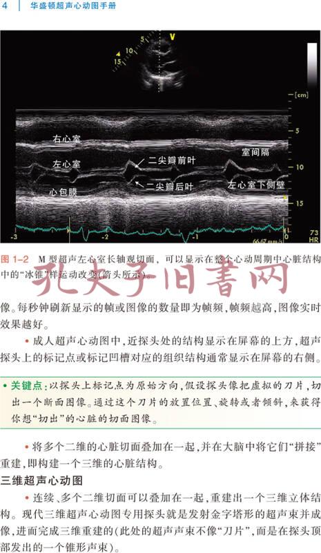 华盛顿超声心动图手册