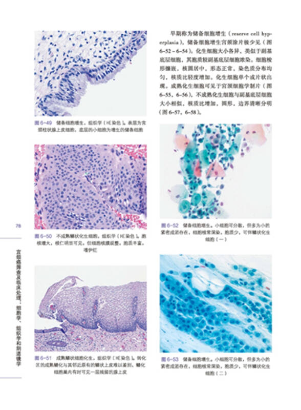宫颈癌筛查及临床处理:细胞学,组织学和阴道镜学