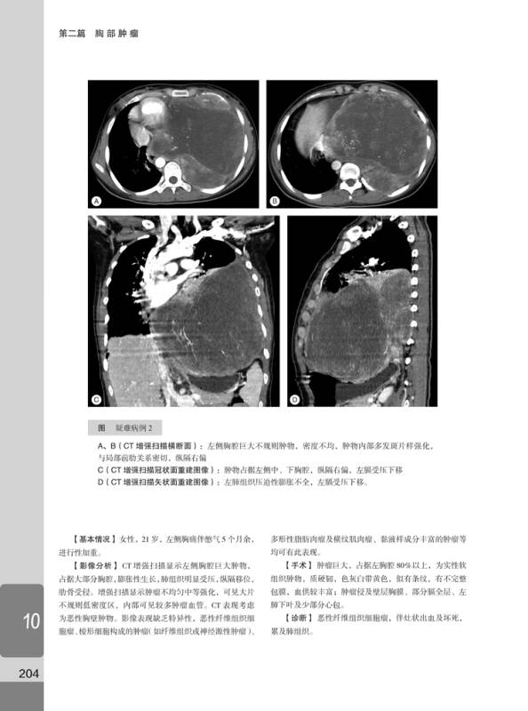 mri_高胆红素脑病mri_mri mrs