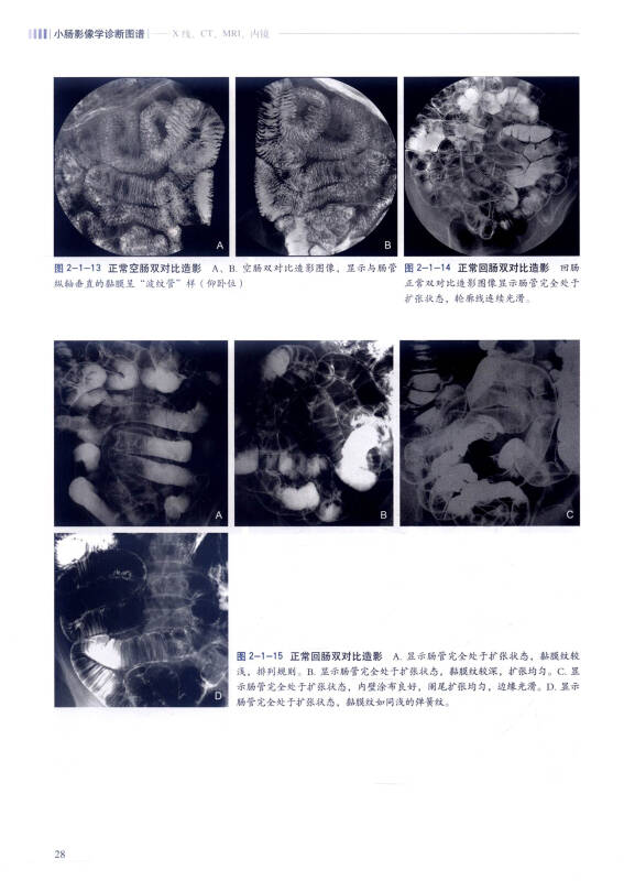 小肠影像学诊断图谱:x线,ct,mri,内镜