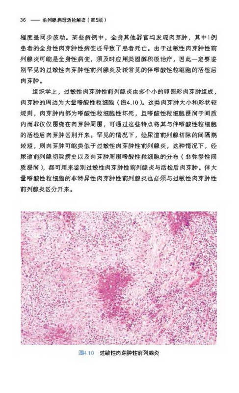 前列腺病理活检解读(第5版)