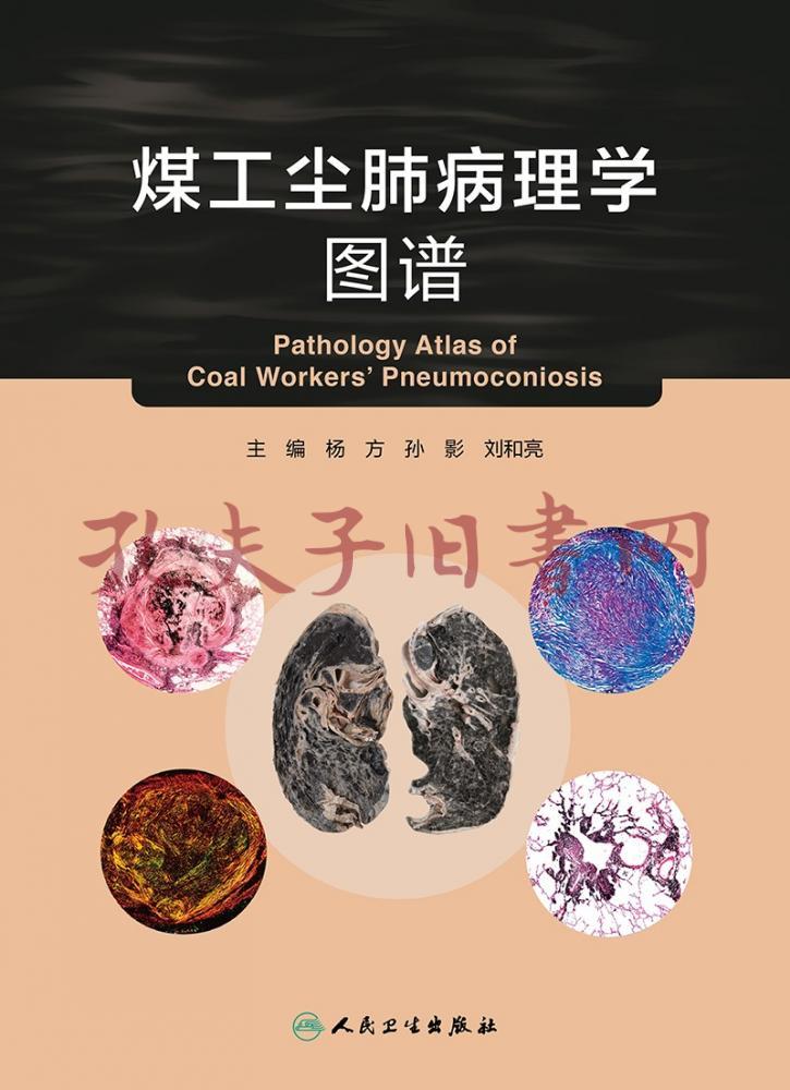 煤工尘肺病理学图谱
