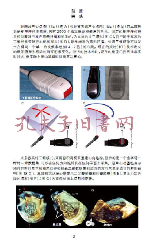实时三维经食管超声心动图手册
