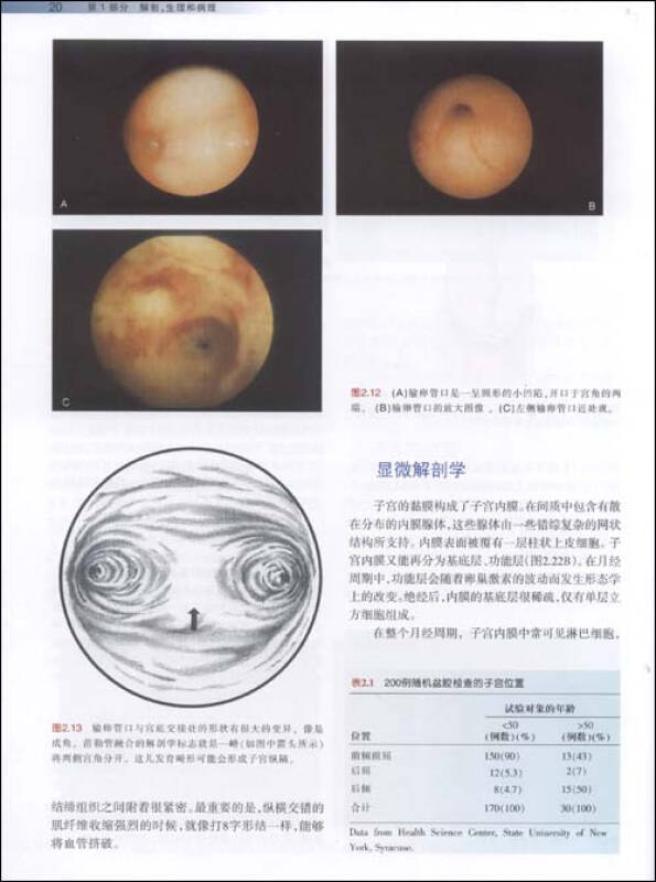 宫腔镜诊断及手术:解剖,生理,病理学图解