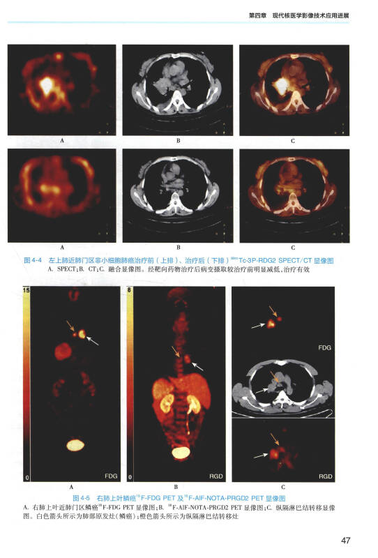 影像核医学与分子影像(第3版 配增值)