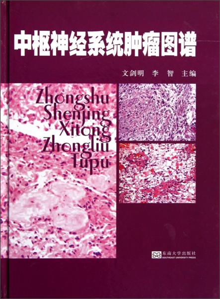 中樞神經(jīng)系統(tǒng)腫瘤圖譜