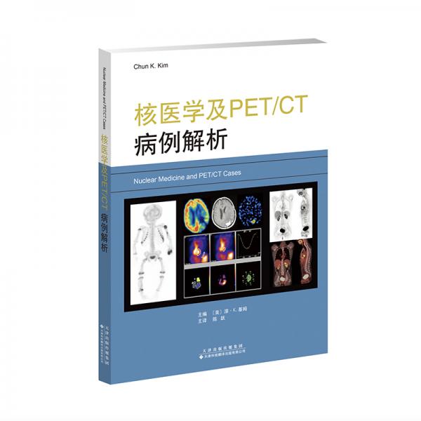 核医学及PET/CT病例解析