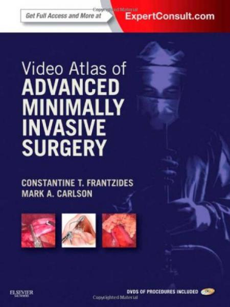 Video Atlas of Advanced Minimally Invasive Surgery: Expert Consult - Online and Print