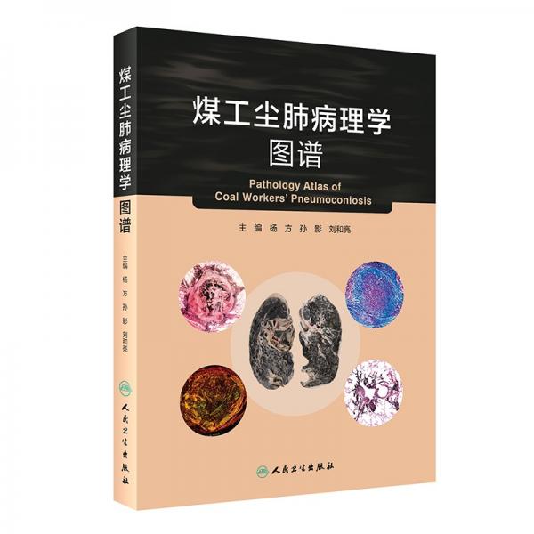 煤工尘肺病理学图谱