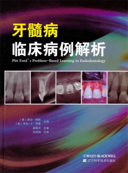 牙髓病临床病例解析
