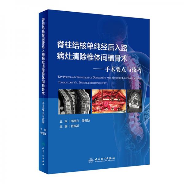 脊柱结核单纯经后入路病灶清除与椎体间植骨术：手术要点与技巧（配增值）