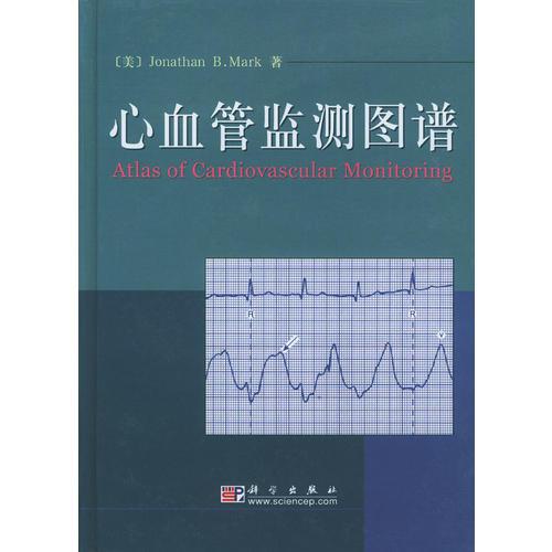 心血管監(jiān)測圖譜