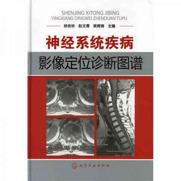 神經(jīng)系統(tǒng)疾病影像定位診斷圖譜