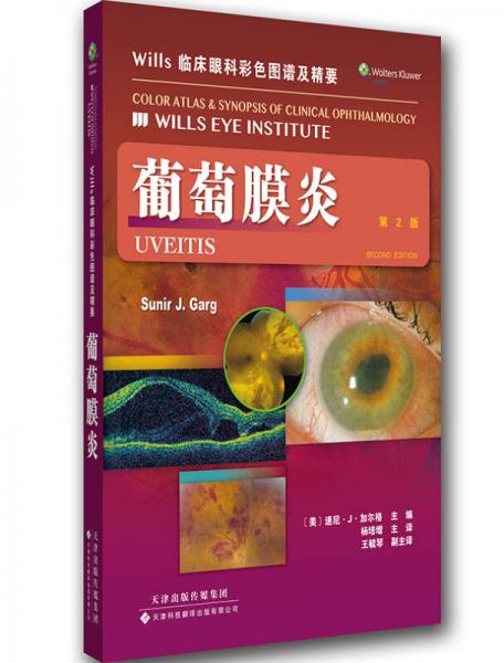 Wills 临床眼科彩色图谱及精要 葡萄膜炎
