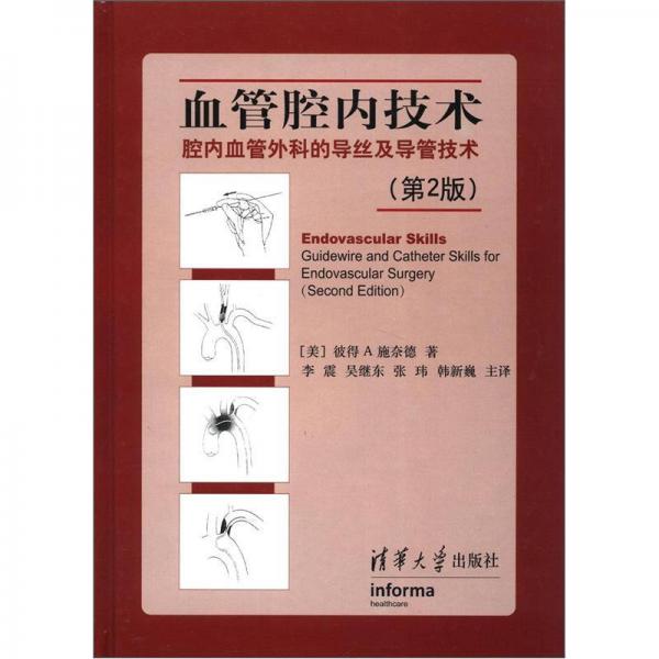 血管腔内技术：腔内血管外科的导丝及导管技术（第2版）