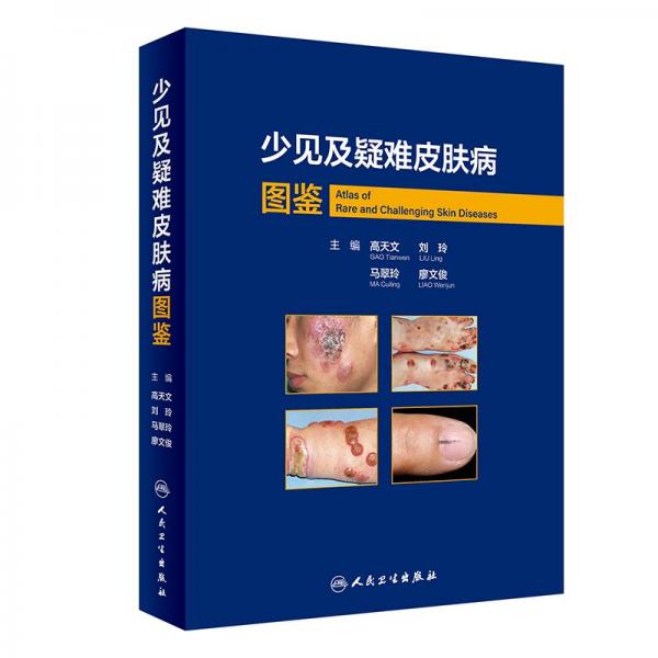 少見及疑難皮膚病圖鑒 高天文 等 編