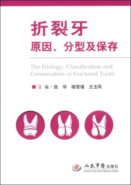 折裂牙原因、分型及保存