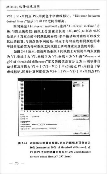 Mimics軟件臨床應用：計算機輔助外科入門技術