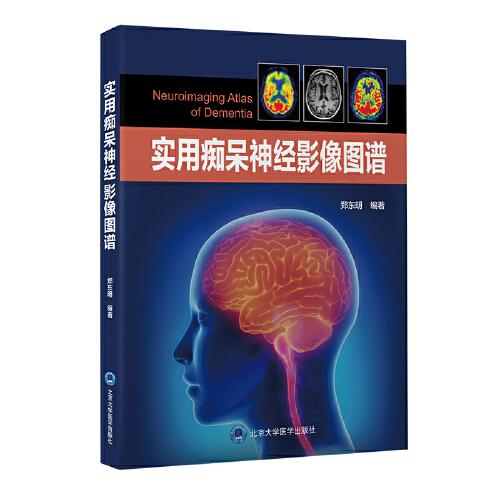 實(shí)用癡呆神經(jīng)影像圖譜