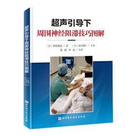 超聲引導(dǎo)下周圍神經(jīng)阻滯技巧圖解