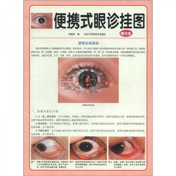 便携式眼诊挂图