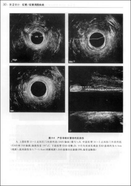 盆底与肛管直肠疾病影像学图谱