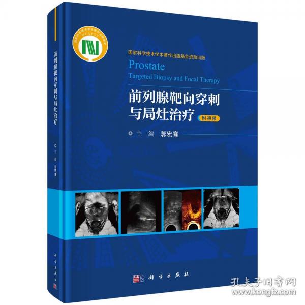 前列腺靶向穿刺與局灶治療
