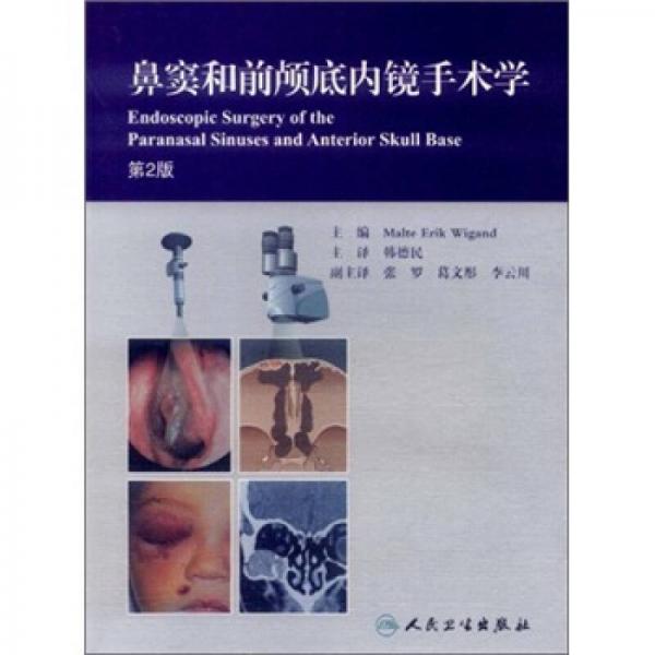 鼻窦和前颅底内镜手术学（第2版）