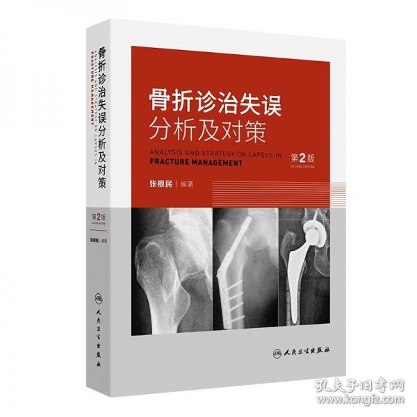 骨折診治失誤分析及對(duì)策 第2版