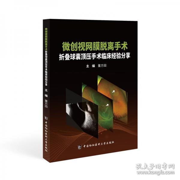 微創(chuàng)視網(wǎng)膜脫離手術 折疊球囊頂壓手術臨床經驗分享