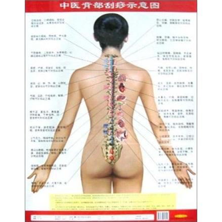 中醫(yī)背部刮痧示意圖