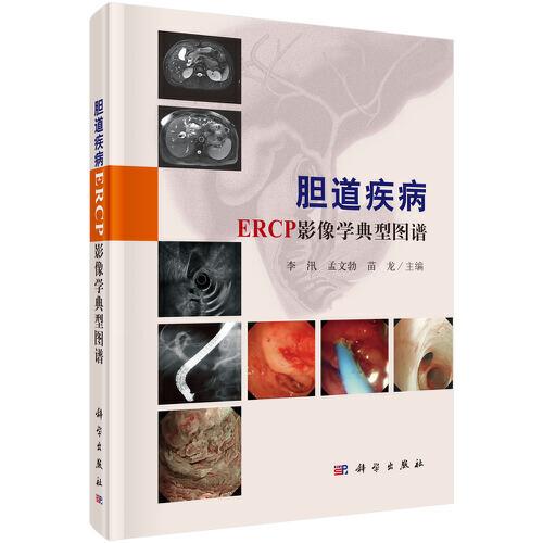 膽道疾病ERCP影像學(xué)典型圖譜