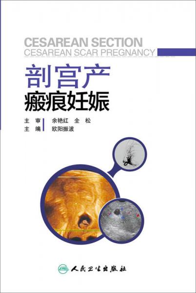 剖宮產(chǎn)瘢痕妊娠