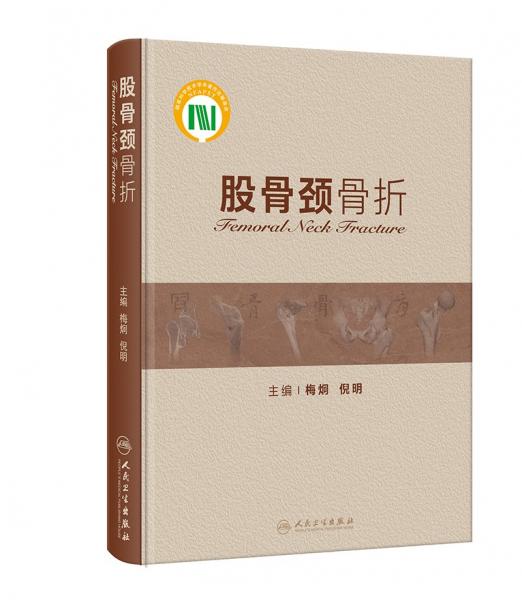 股骨頸骨折
