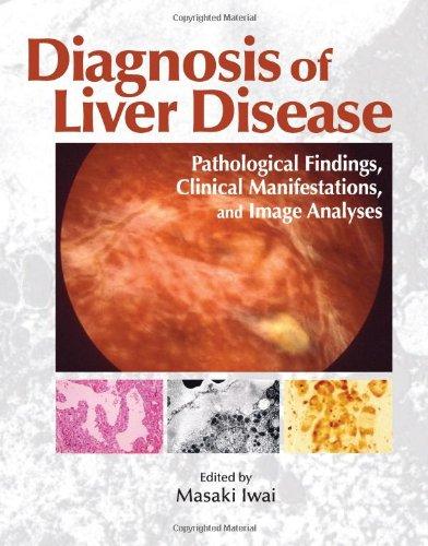 DIAGNOSISOFLIVERDISEASE