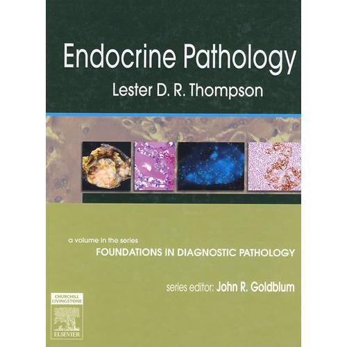 内分泌病理学：Endocrine Pathology