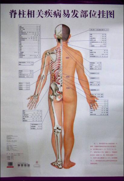 脊柱相关疾病易发部位挂图