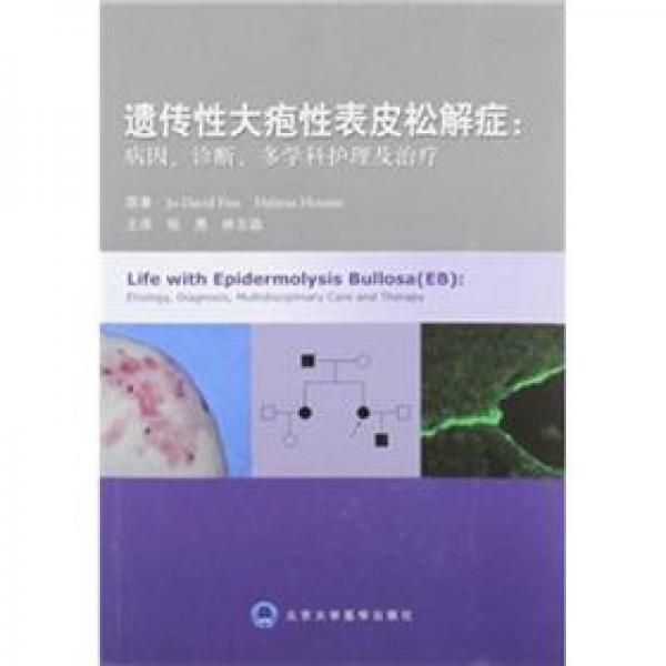 遗传性大疱性表皮松解症：病因、诊断、多学科护理及治疗