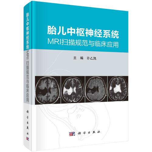 胎兒中樞神經(jīng)系統(tǒng)MRI掃描規(guī)范與臨床應(yīng)用