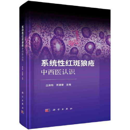 系統(tǒng)性紅斑狼瘡中西醫(yī)認(rèn)識(shí)